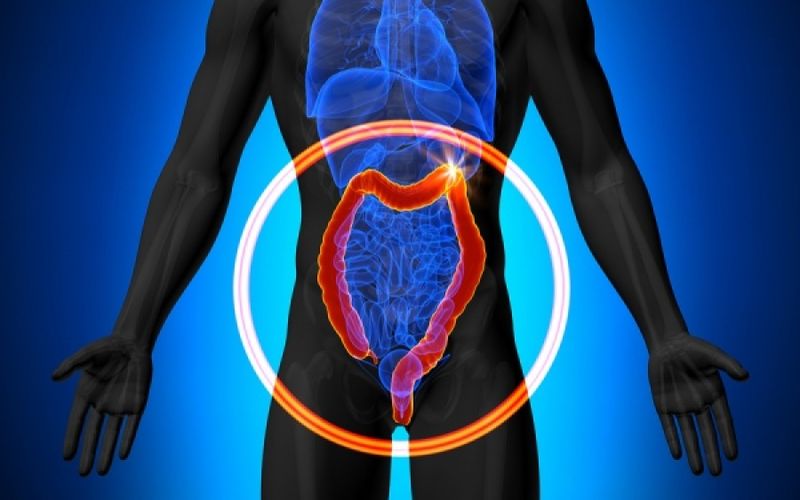 Πρόγραμμα πρόληψης για τον Καρκίνο του Παχέος Εντέρου - Δωρεάν εξετάσεις σε ανασφάλιστους από οικονομικά αδύναμες οικογένειες