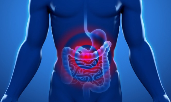 Εκστρατεία αφιερωμένη  στην πρόληψη του Καρκίνου του παχέος εντέρου